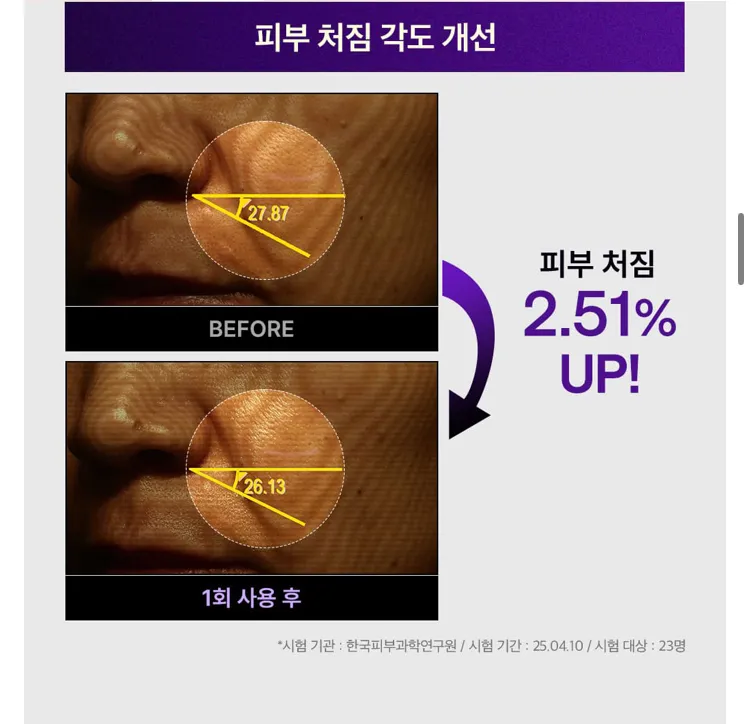 (하루특가) 메디힐 PDRN 리프팅 세럼 40ml